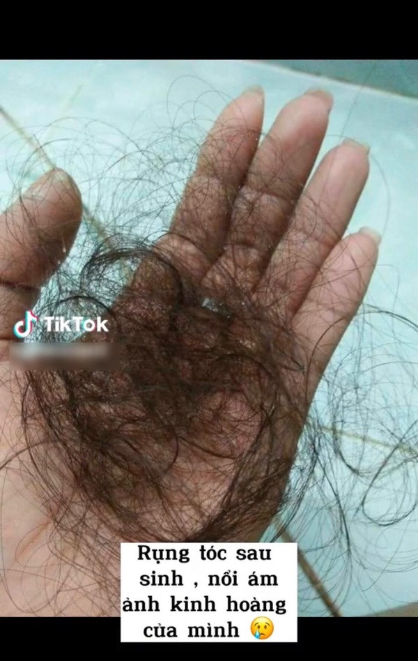 Song, trong thời kỳ mang bầu và sau khi sinh con, bạn gái đã phải trải qua nhiều nỗi ám ảnh của một “bà mẹ bỉm sữa”.