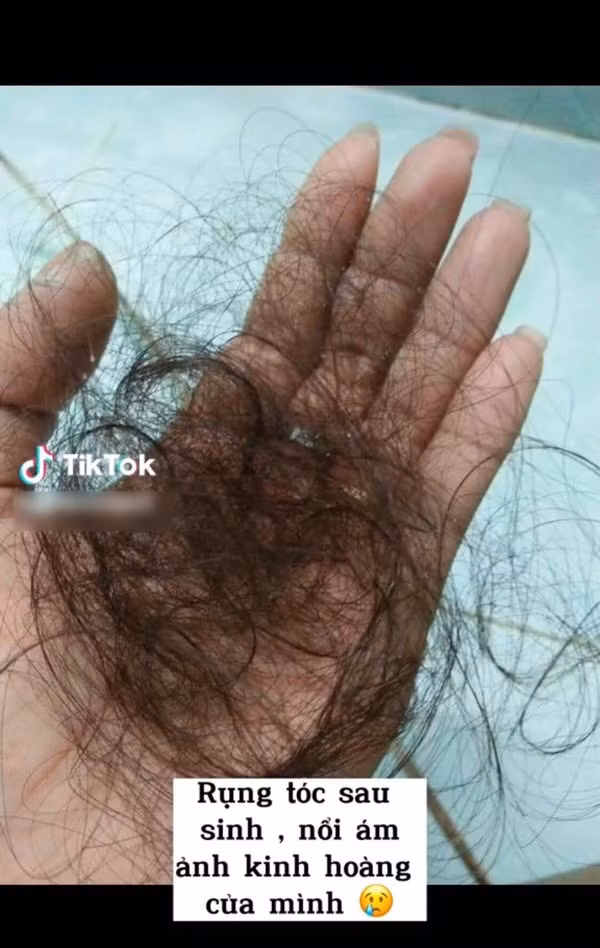 Song, trong thời kỳ mang bầu và sau khi sinh con, bạn gái đã phải trải qua nhiều nỗi ám ảnh của một “bà mẹ bỉm sữa”.