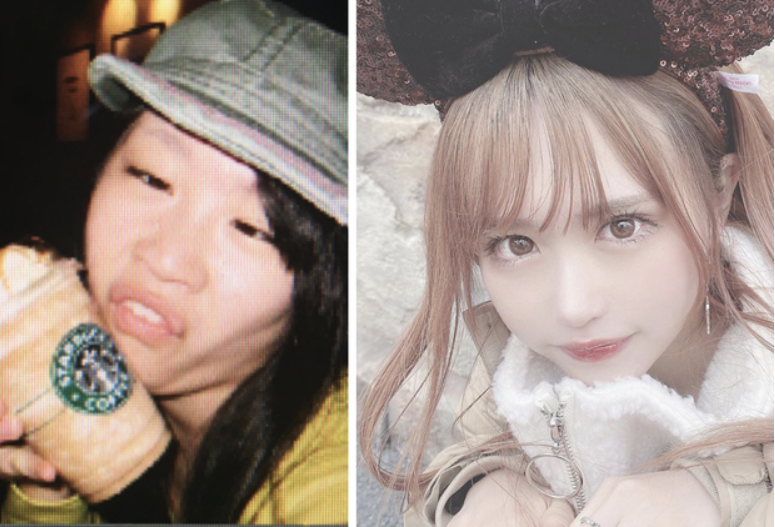 Cô bạn này ngày trước chẳng hề kém sắc nhưng rõ ràng, sau khi "dao kéo", nhan sắc cô nàng còn lên hạng gấp nhiều lần.