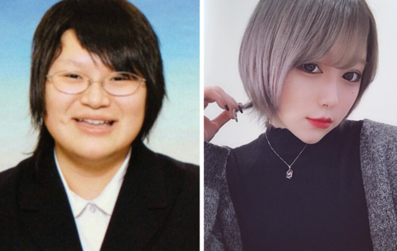 Được xinh lên thì chấp nhận tốn kém hay đau đớn một chút chắc nhiều cô gái cũng sẽ chấp nhận.