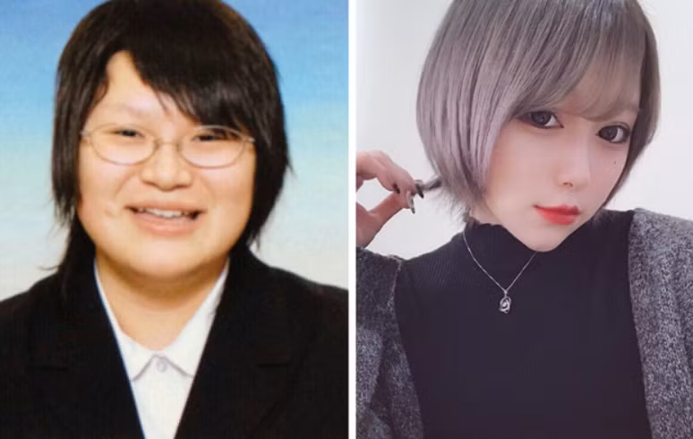 Được xinh lên thì chấp nhận tốn kém hay đau đớn một chút chắc nhiều cô gái cũng sẽ chấp nhận.