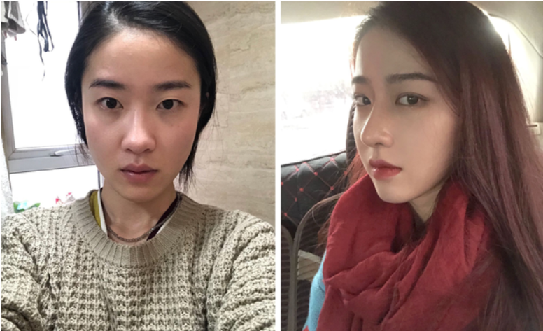 Chỉ cần biết tiết chế một chút, không phẫu thuật thẩm mỹ quá đà, chọn địa chỉ uy tín thì việc "vịt hoá thiên nga" sẽ vô cùng thuận lợi.