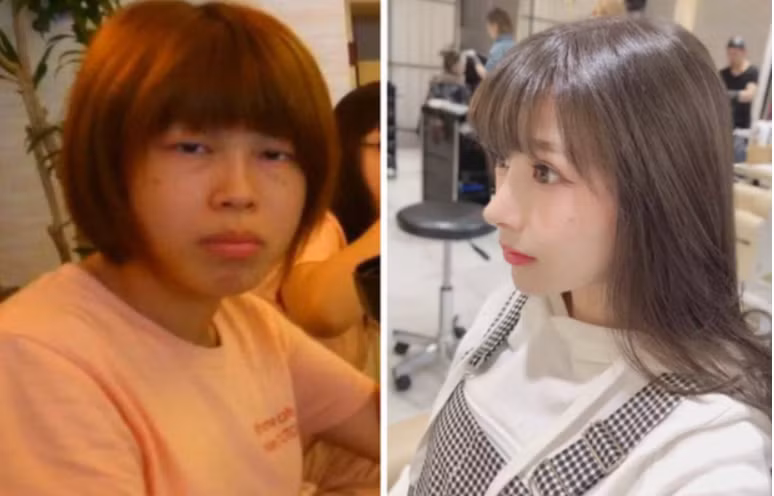 Đẹp tự nhiên tất nhiên là tốt nhất. Nhưng nếu điều kiện không cho phép, chẳng ai cấm bạn đẹp nhân tạo.