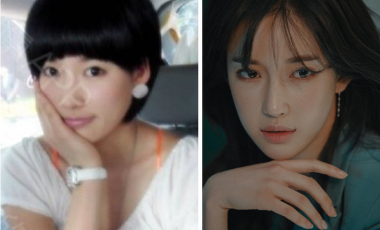 Đôi khi bạn đâu cần "đập đi xây lại" cả gương mặt, sửa một chi tiết, một bộ phận chẳng hạn như mũi thôi cũng đủ tạo ra khác biệt.