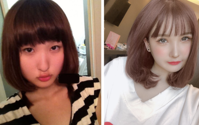 Nhiều hot girl đã ra đời sau khi can thiệp "dao kéo" lên khuôn mặt.