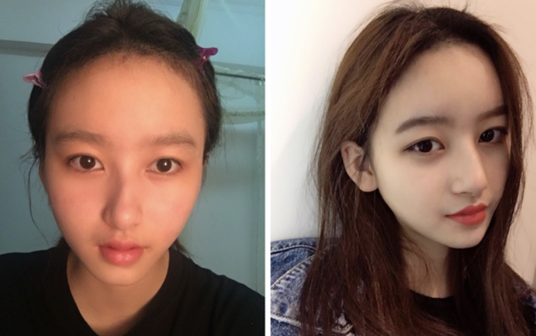 Dù muốn hay không, bạn cũng không thể phủ nhận được sức mạnh của việc phẫu thuật thẩm mỹ thành công mang đến cho hội chị em nhan sắc "cực phẩm".