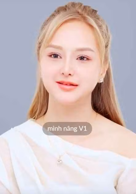 Thậm chí, hot TikToker mới đây còn thừa nhận, bản thân chính thức "đam mê" phẫu thuật thẩm mỹ.