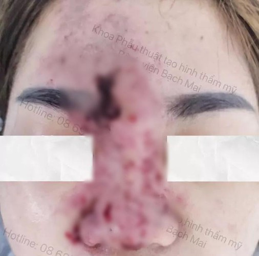 Vậy nên hãy là người làm đẹp thông thái, chọn cơ sở uy tín mà làm, tết nhất đến nơi rồi kẻo "xuân này con không thể đi chơi".