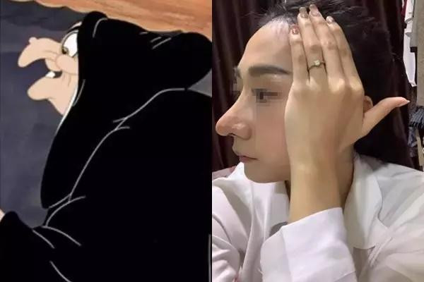 Ngay khi hình ảnh xuất hiện đã thu hút bão tương tác. Đa số đều là chê bai, người ví chiếc mũi như cầu trượt, số khác bày tỏ nhìn thế nào cũng thấy giống phù thủy.