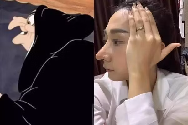 Ngay khi hình ảnh xuất hiện đã thu hút bão tương tác. Đa số đều là chê bai, người ví chiếc mũi như cầu trượt, số khác bày tỏ nhìn thế nào cũng thấy giống phù thủy.