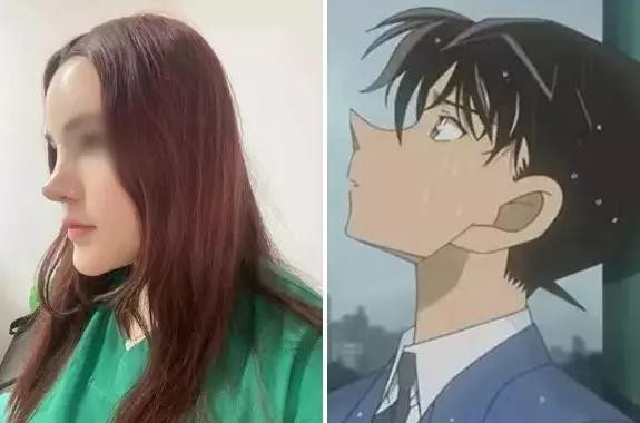 Hình ảnh ghi lại cô gái xuất hiện với chiếc mũi cực kì khó hiểu khi đầu mũi nhọn hoắt, vểnh ngược lên chiếm phần lớn gương mặt.