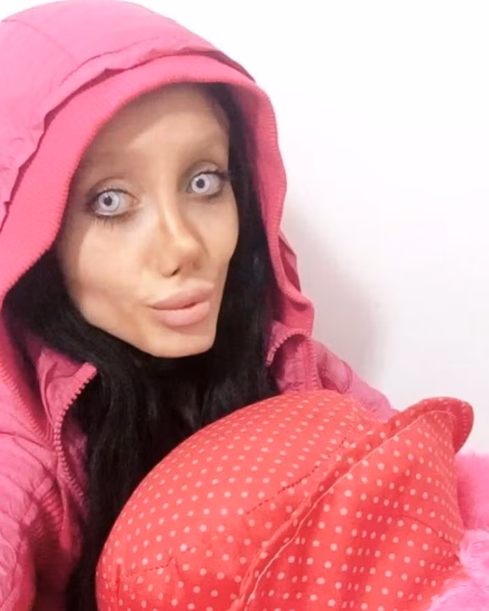 Gương mặt của Sahar Tabar khiến mọi người liên tưởng đến ngôi sao Hollywood Angelina Jolie nhưng trong một phiên bản “kinh dị”.