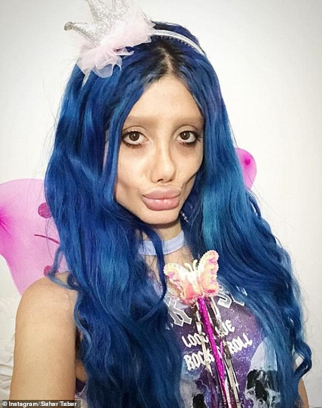 Tabar khiến mọi người tin rằng vẻ ngoài giống như một “thây ma” của cô là do phẫu thuật thẩm mỹ hỏng.