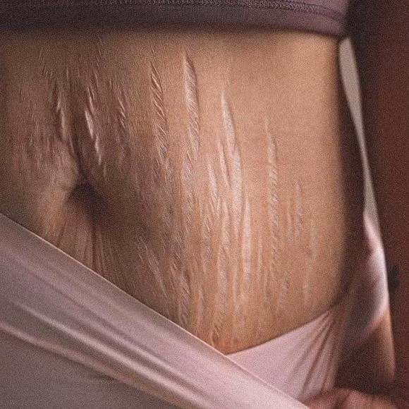 Mới đây, vợ của Phan Văn Đức đăng bức ảnh rạn da bụng sau khi sinh. Cô chia sẻ: "Chúc mừng 8/3, hãy trân trọng người phụ nữ bên cạnh bạn. Hãy nhớ rằng cơ thể của cô ấy đã đẹp đẽ, mịn màng và được điêu khắc thế nào khi bắt đầu cuộc hôn nhân với bạn. Cô ấy vẫn là người phụ nữ xinh đẹp đó, vẫn là tâm hồn đó mà bạn hằng thương yêu. Chỉ khác là cô ấy đã cho những đứa con của bạn cuộc sống.