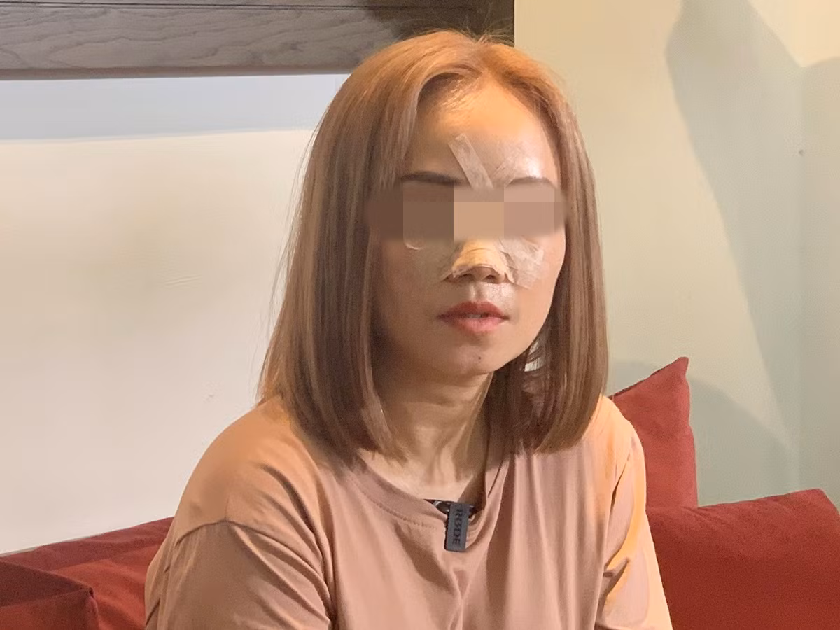 Sau khi biết chiếc mũi của người phụ nữ vẫn an lành, dân mạng lại tiếp tục "chê" vì màn câu like, tương tác "khó chịu" của người phụ nữ. Ảnh minh hoạ.