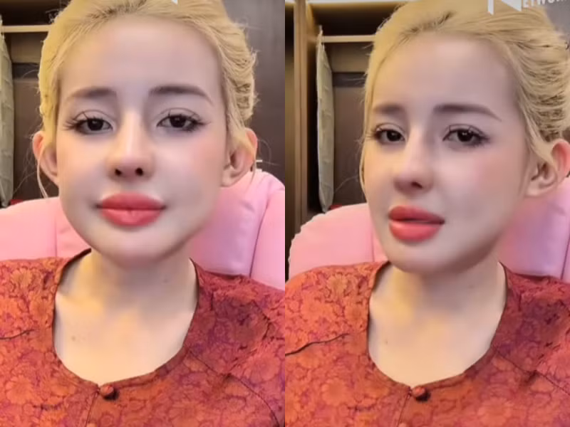 Ngân 98 còn phản bác trước ý kiến trái chiều của cộng đồng mạng: "Mình thấy bản thân trẻ không nhận ra. Với mắt thẩm mỹ cá nhân mình thấy rất xinh, ai nói gì mình cũng không lung lay".