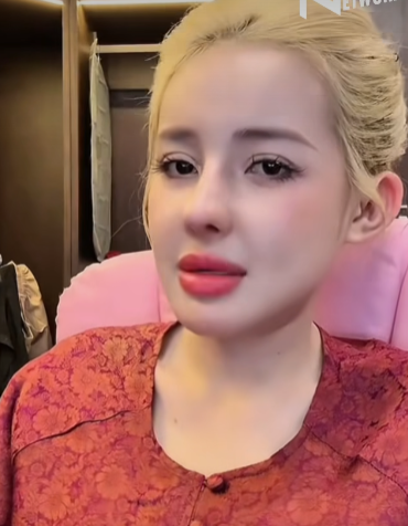 Gần nhất, nữ hoàng thẩm mỹ đã chỉnh sống mũi, tháo cằm, hạ gò má. Khi ấy, chính chủ cho biết cô muốn hình ảnh bản thân mới mẻ trong mắt công chúng.