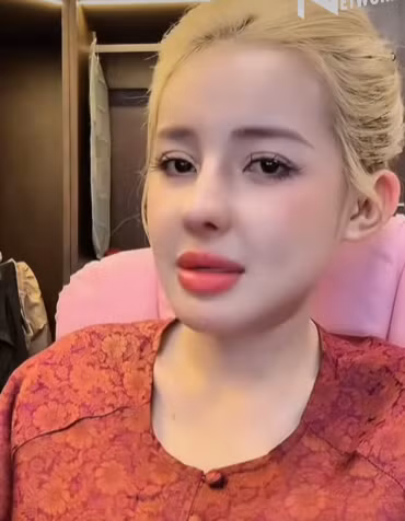 Gần nhất, nữ hoàng thẩm mỹ đã chỉnh sống mũi, tháo cằm, hạ gò má. Khi ấy, chính chủ cho biết cô muốn hình ảnh bản thân mới mẻ trong mắt công chúng.