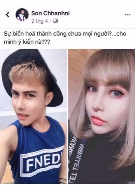 Bẵng đi một thời gian dài, người ta lại thấy tài khoản Facebook của thảm họa mạng Tùng Sơn chia sẻ hình ảnh mới của anh chàng hậu phẫu thuật thẩm mỹ.