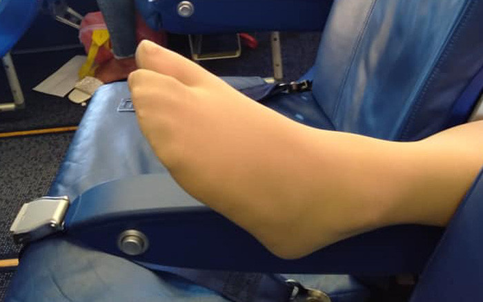 Tuy nhiên, bên cạnh đó cũng có ý kiến cho rằng việc ra tay như vậy thực ra là cũng không nên, thay vào đó mình nên nhắc nhở người ngồi sau để họ co chân lại thì sẽ nhẹ nhàng hơn rất nhiều.