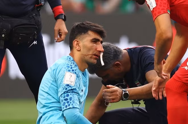 Ngay sau đó, Beiranvand phải nằm sân, thay cho anh là thủ môn dự bị Hossein Hosseini. Anh rời sân bằng cáng.