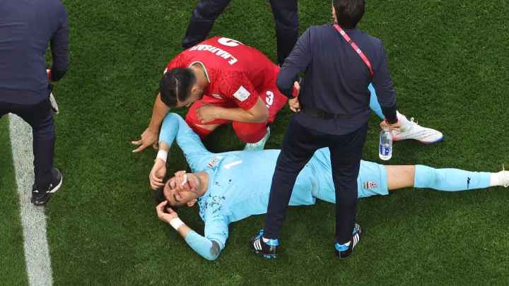 Sau thời gian tham vấn, tại cuộc họp thường niên vào tháng 12/2020, IFAB đã phê duyệt thử nghiệm thay thế người bị chấn thương vĩnh viễn và nói rõ đội bóng không nên bị phạt trong tình huống này. Đó là lý do HLV được phép thay người bổ sung cho cầu thủ bị chấn thương.