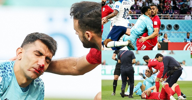 Theo tạp chí The Athletic, nhân viên y tế đã kiểm tra sức khỏe cho thủ thành Alireza Beiranvand. Các bước đều đã được huấn luyện và có quy định chi tiết.