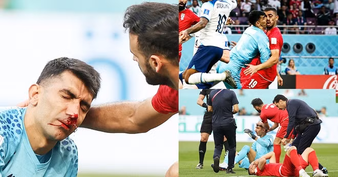 Theo tạp chí The Athletic, nhân viên y tế đã kiểm tra sức khỏe cho thủ thành Alireza Beiranvand. Các bước đều đã được huấn luyện và có quy định chi tiết.