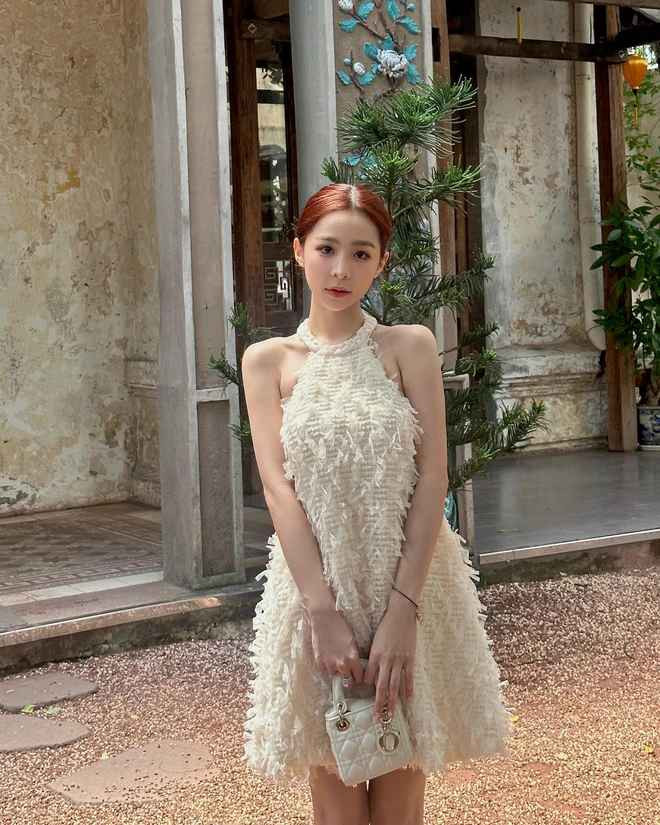 “Việc can thiệp phẫu thuật thẩm mỹ ở hiện tại là hết sức bình thường, ai cũng có quyền trở nên đẹp hơn. Thậm chí mình còn ngưỡng mộ quyết định nhờ cậy đến ‘dao kéo’ của mọi người vì khát khao cái đẹp của họ phải rất mạnh mẽ mới có thể chịu đau như thế” - bạn gái B Ray bày tỏ quan điểm.