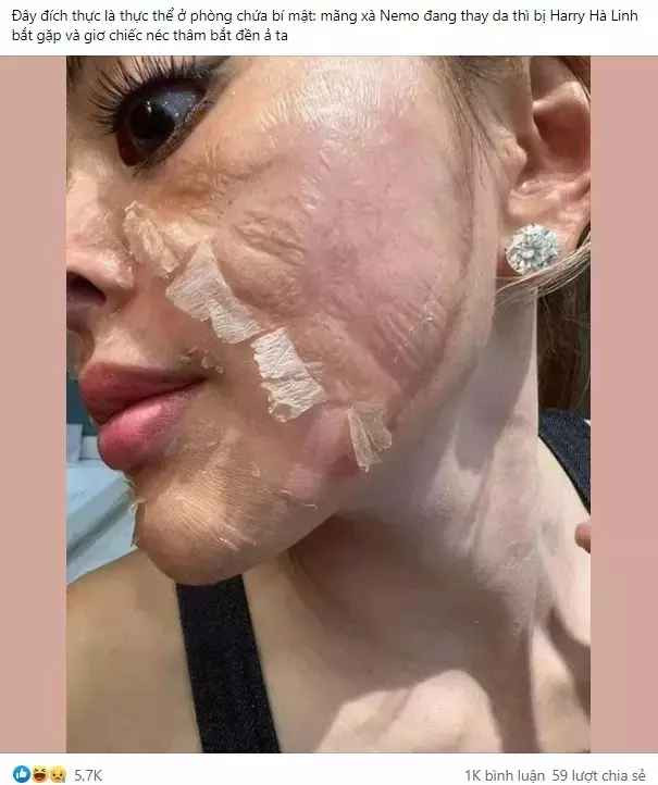 Hiện thông tin cô gái chia sẻ đang gây xôn xao cõi mạng. Nhìn gương mặt người này, cư dân mạng bày tỏ khiếp sợ, tự nhủ lòng "thà xấu tự nhiên còn hơn sử dụng sản phẩm Trang Nemo".