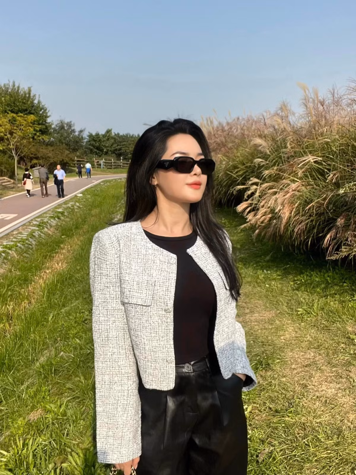 Thanh Quỳnh nói: "Chắc phải gần một năm tôi mới nhận thức điều này, bởi lúc phẫu thuật xong vẫn ở Nam Định, ít ra ngoài tiếp xúc ai. Có một lần thú vị là hôm đó khi đi taxi xuống Hà Nội, hôm ấy không có tiền lẻ, chỉ có một tờ 500 nghìn nên lúc đưa anh tài xế, anh bảo: "Thôi em không cần trả đâu, lần sau đưa anh cũng được". Đến lúc đó mình mới nhận thức bản thân thay đổi rồi, nếu là gương mặt mình ngày xưa chắc chắn không như thế đâu".