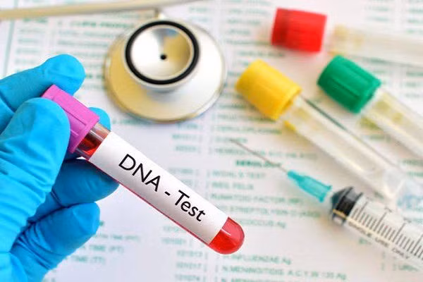 Hoi ket soc khi di xet nghiem ADN vi chong nghi phai “do vo”