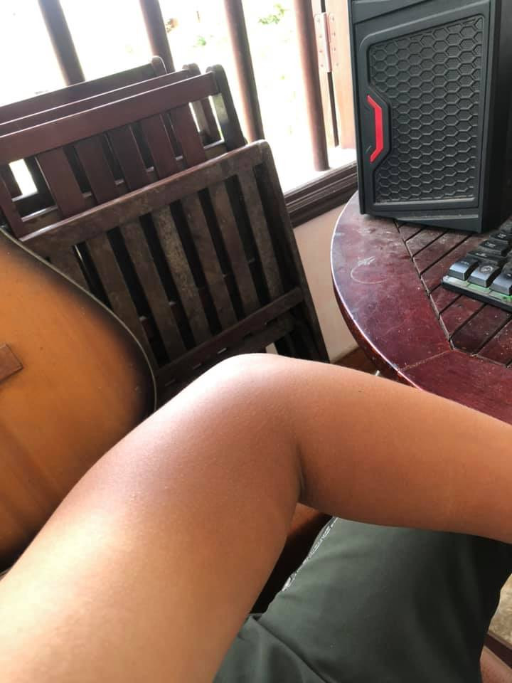 Một bộ phận không nhỏ trong số người làm nghề thường xuyên phải chạy bên ngoài đường như shipper, xe ôm công nghệ thì tình trạng da chia hai màu diễn ra là điều khó tránh khỏi.