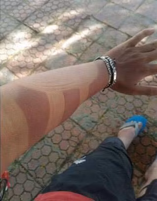 Nhìn những hình ảnh cháy nắng, chắc chắn ai khi chuẩn bị ra đường vào trưa hè cũng phải nghĩ ngợi để suy nghĩ ra cách phòng, chống việc làn da bị hủy họa do nắng.