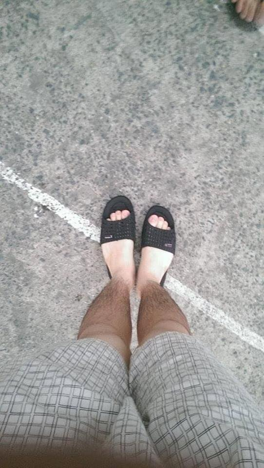 Đa phần, dân mạng đều chia sẻ những bức ảnh làn da chia 2 màu rõ rệt "nửa đen - nửa trắng" của mình.