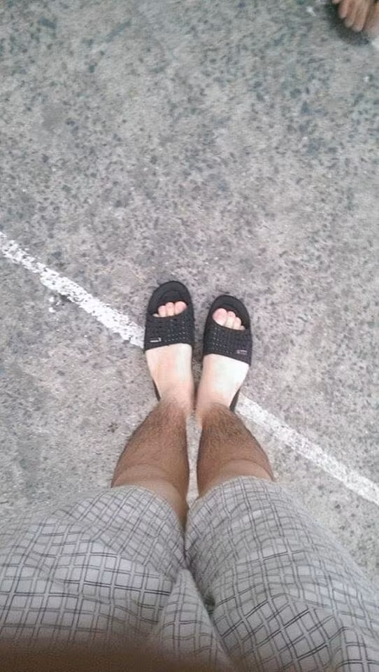 Đa phần, dân mạng đều chia sẻ những bức ảnh làn da chia 2 màu rõ rệt "nửa đen - nửa trắng" của mình.