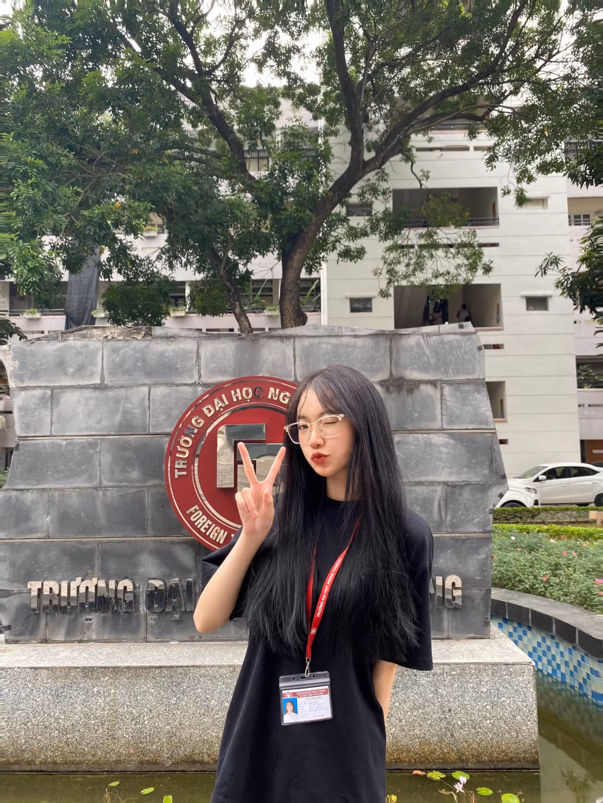 Nu sinh Ngoai thuong 18 tuoi gay chu y tai Hoa hau Viet Nam-Hinh-2