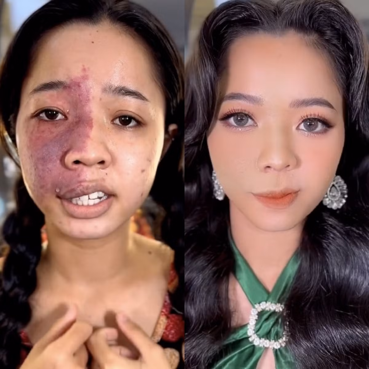 Hình ảnh trước và sau màn biến hình của cô gái bị "phong ấn" nhan sắc.