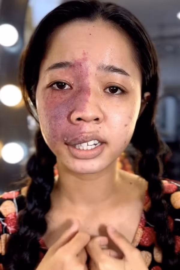 Người thợ make up đăng tải kèm dòng trạng thái: “Gỡ phong ấn cho em ấy”. Có thể thấy, nhân vật chính trong đoạn clip là một cô gái nửa bên mặt có vết bớt đỏ. Một nửa mặt bên lại của cô cũng có thâm mụn, lỗ chân lông to.