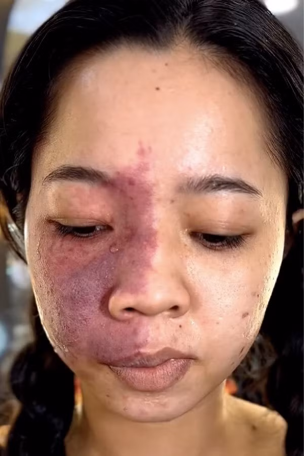 Mới đây, một người dùng mạng xã hội đã chia sẻ lại quá trình trang điểm, giúp một cô gái có vẻ đẹp bị “phong ấn” trở nên tự tin, khắc phục khuyết điểm tôn lên những đường nét mềm mại trên khuôn mặt.