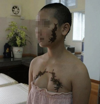 Một cô gái khác xăm hình con rết lên chính gương mặt từng khiến nhiều người đặt câu hỏi lớn.