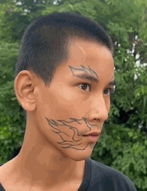 Chàng trai này nghĩ rằng xăm hình sẽ giúp mình "bắt kịp" bạn bè, không bị lạc lõng. Thế nhưng, chỉ một thời gian ngắn sau đó, cậu thiếu niên đã nhanh chóng phải trả giá đắt cho quyết định bốc đồng này.