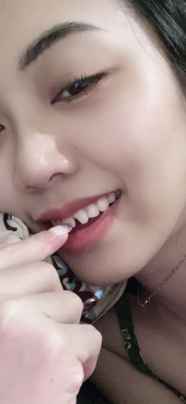 Để "chữa cháy", Ánh Tuyết đã phải vào nhóm gấp rút nhờ đồng nghiệp thay ca giùm. Lúc đầu, mọi người không nhận nhưng lúc cô nàng gửi ảnh tình trạng răng miệng thì đã có người thương cảm.