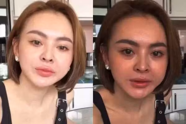 Trang Nemo còn cho biết, mặt cô bị lệch một bên tuy nhiên điều này có vẻ không ảnh hưởng lắm đến tổng thể gương mặt. Nếu hot girl thị phi không tự nói cũng chẳng ai nhận ra khuyết điểm này.