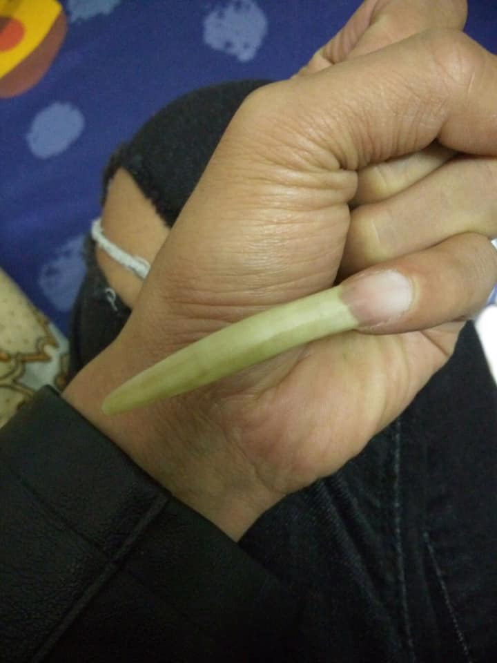 Lần mò trên MXH, Không ít người cũng chia sẻ sở thích sưu tầm những chiếc móng tay bị cắt bỏ của mình.