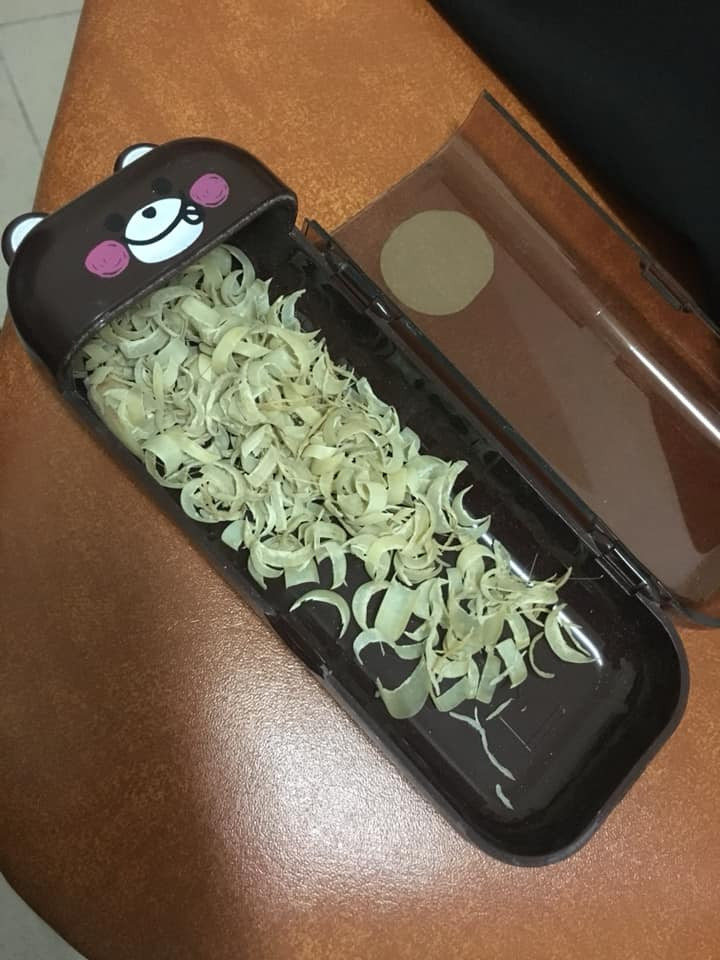 Theo dòng thời gian, những móng tay thừa này đã cũ, úa vàng, nhìn trông cũng khá kinh dị, rùng mình.