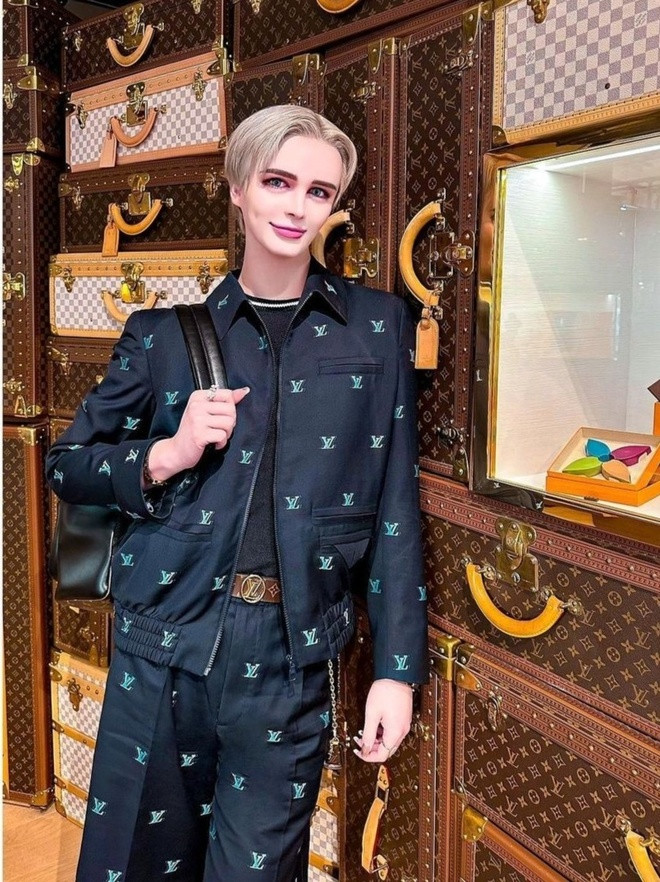 Làn da Matt ngày càng trắng đến nhợt nhạt, mũi nhỏ, thẳng tắp, môi và hàm cũng có nhiều điểm khác lạ.