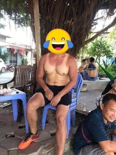 Ông chú này bị hằn nguyên dấu vết của chiếc áo ngắn tay lên thân hình vạm vỡ.