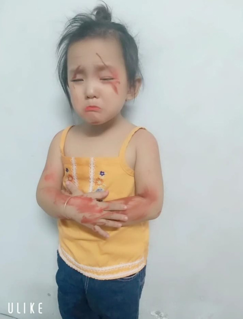 Dù hậu quả gây ra "nặng nề" nhưng những trường hợp "phấn son tặc" này các bà mẹ không thể bắt đền.