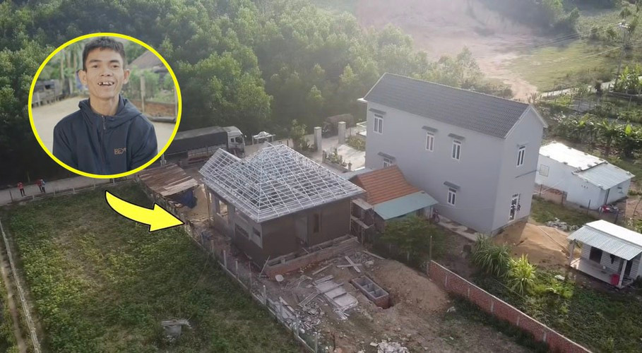 So Y Tiết cũng cho hay công việc hiện tại của anh chủ yếu là làm trên các trang mạng xã hội nước ngoài. Khi nào có người thuê làm quảng cáo thì anh sẽ làm và tập trung hát số. Còn thu nhập từ YouTube không quá lớn, có tháng chỉ được 2 triệu đồng.